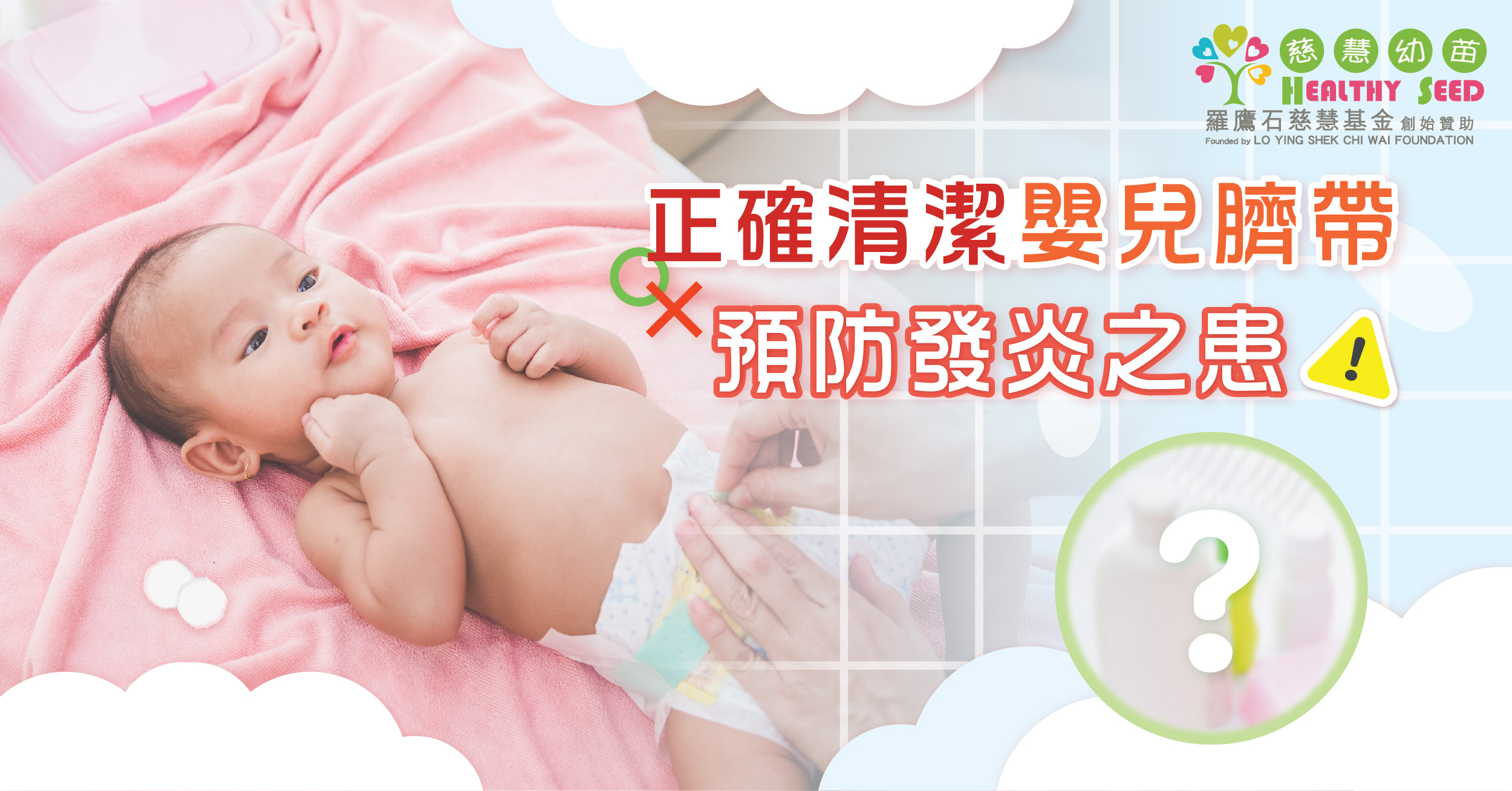 正確清潔嬰兒臍帶     預防發炎之患